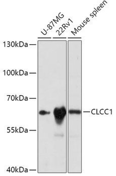 Cell Biology Antibodies 13 Anti-CLCC1 Antibody CAB17656