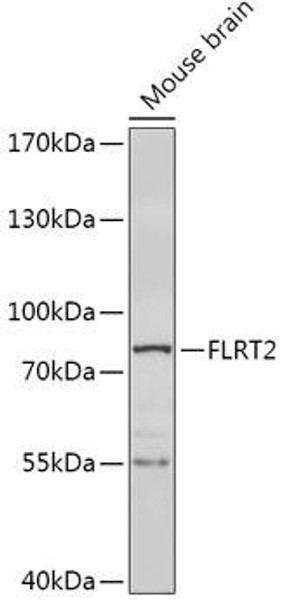 Cell Biology Antibodies 13 Anti-FLRT2 Antibody CAB17668