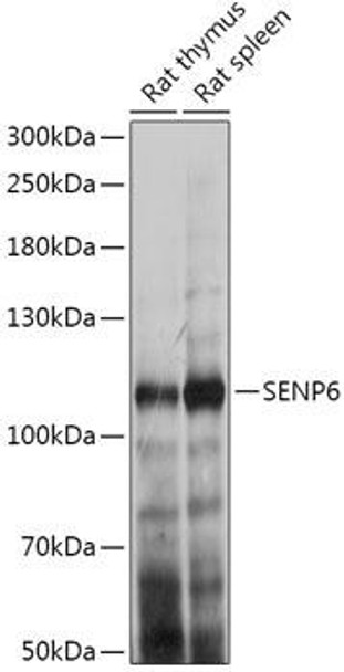 Cell Biology Antibodies 13 Anti-SENP6 Antibody CAB17673