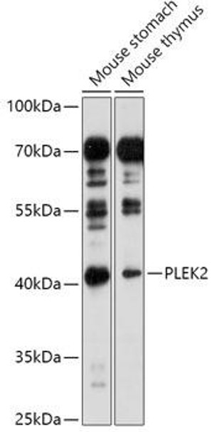Cell Biology Antibodies 13 Anti-PLEK2 Antibody CAB17682