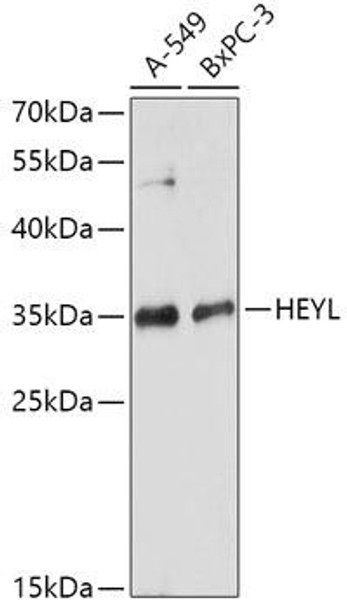 Cell Biology Antibodies 13 Anti-HEYL Antibody CAB17683