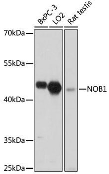Cell Biology Antibodies 13 Anti-NOB1 Antibody CAB17690