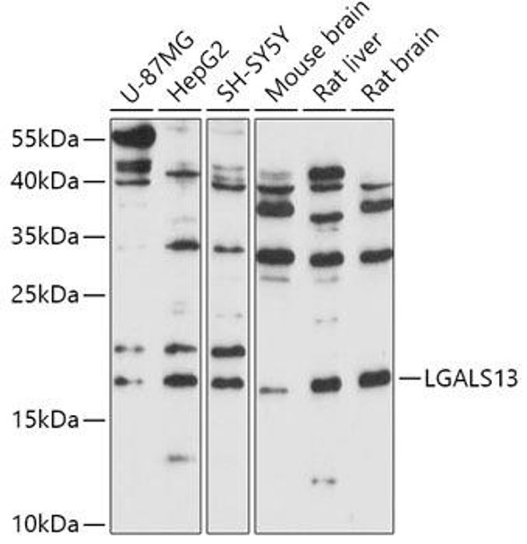 Cell Biology Antibodies 13 Anti-LGALS13 Antibody CAB17691