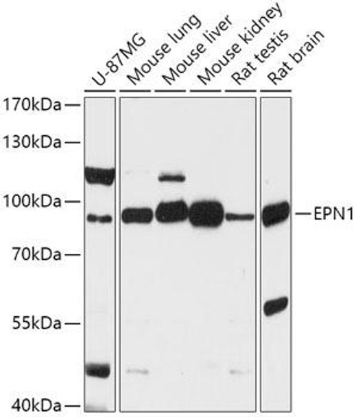 Cell Biology Antibodies 13 Anti-EPN1 Antibody CAB17695