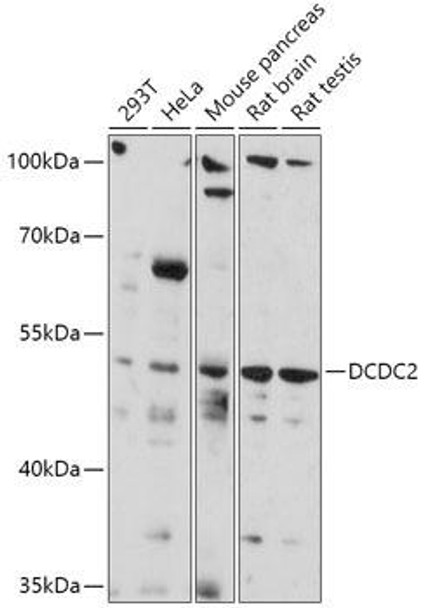 Cell Biology Antibodies 13 Anti-DCDC2 Antibody CAB17704