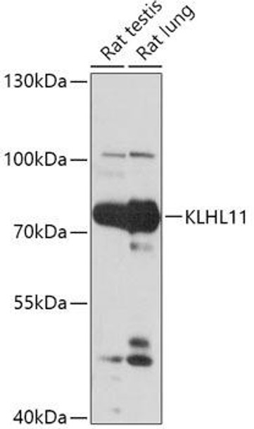 Cell Biology Antibodies 13 Anti-KLHL11 Antibody CAB17717