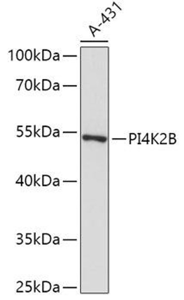 Cell Biology Antibodies 13 Anti-PI4K2B Antibody CAB17719