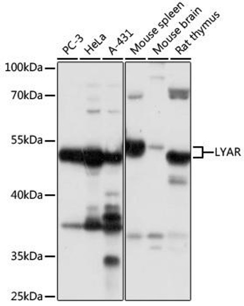 Cell Biology Antibodies 13 Anti-LYAR Antibody CAB17724