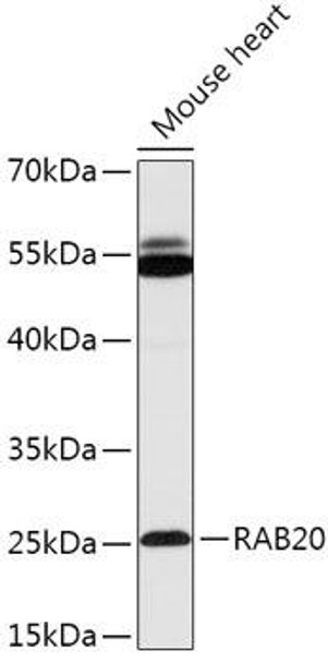 Cell Biology Antibodies 13 Anti-RAB20 Antibody CAB17725