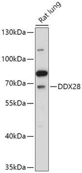 Cell Biology Antibodies 13 Anti-DDX28 Antibody CAB17728