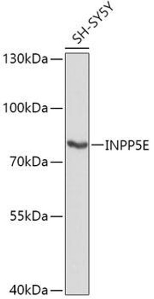 Cell Biology Antibodies 13 Anti-INPP5E Antibody CAB17735