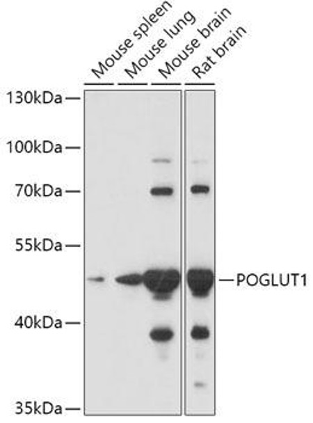 Cell Biology Antibodies 13 Anti-POGLUT1 Antibody CAB17737