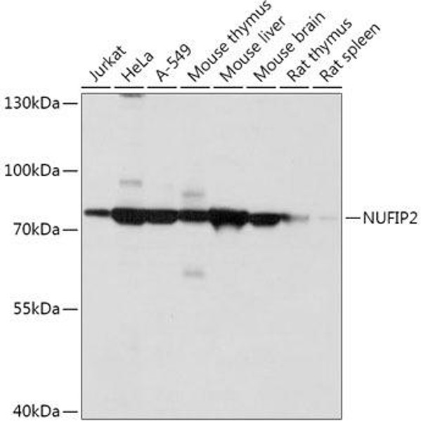 Cell Biology Antibodies 13 Anti-NUFIP2 Antibody CAB17740