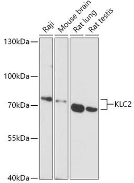 Cell Biology Antibodies 16 Anti-KLC2 Antibody CAB17757