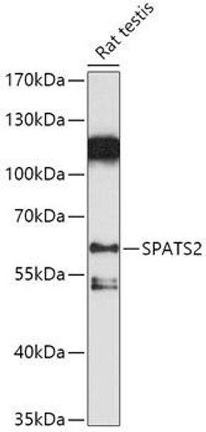 Cell Biology Antibodies 16 Anti-SPATS2 Antibody CAB17762