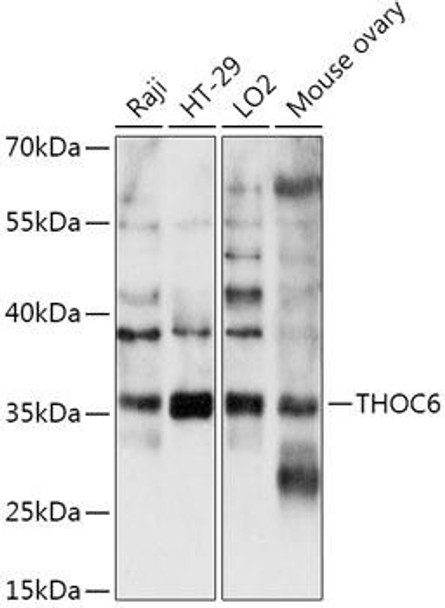 Cell Biology Antibodies 15 Anti-THOC6 Antibody CAB17766