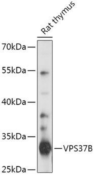 Cell Biology Antibodies 15 Anti-VPS37B Antibody CAB17770