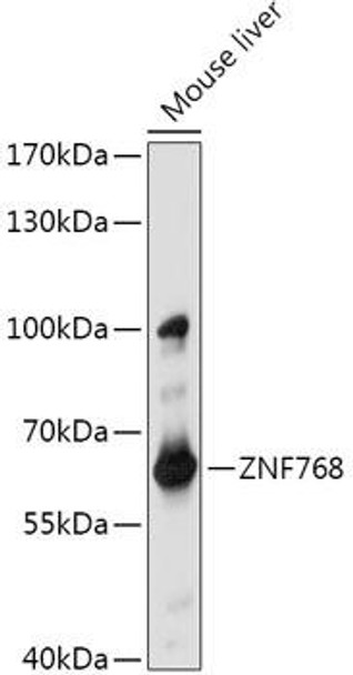 Cell Biology Antibodies 15 Anti-ZNF768 Antibody CAB17771