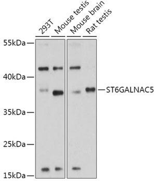 Cell Biology Antibodies 15 Anti-ST6GALNAC5 Antibody CAB17782