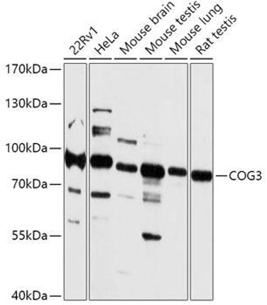 Cell Biology Antibodies 15 Anti-COG3 Antibody CAB17785