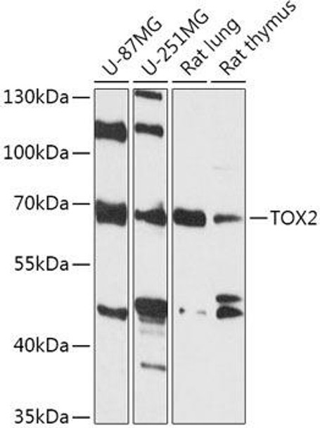 Cell Biology Antibodies 15 Anti-TOX2 Antibody CAB17797