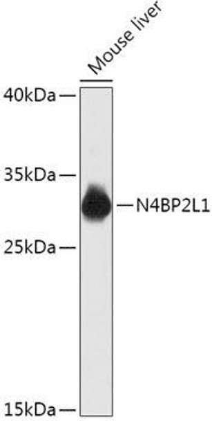 Cell Biology Antibodies 15 Anti-N4BP2L1 Antibody CAB17802