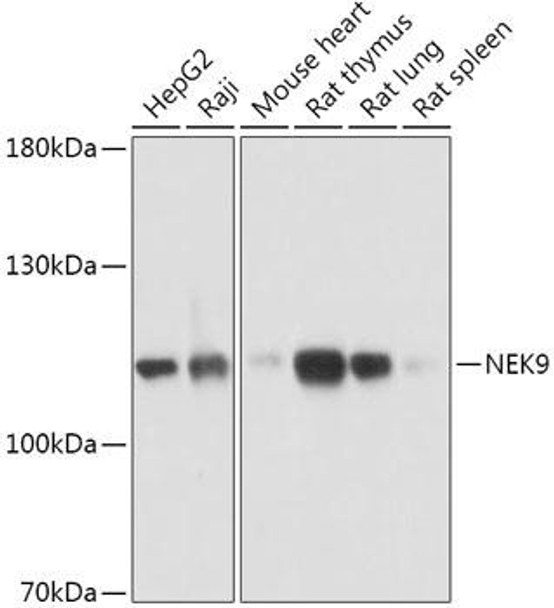 Cell Biology Antibodies 15 Anti-NEK9 Antibody CAB17806