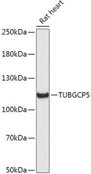 Cell Biology Antibodies 15 Anti-TUBGCP5 Antibody CAB17815