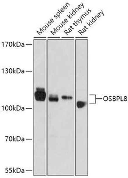 Cell Biology Antibodies 15 Anti-OSBPL8 Antibody CAB17816