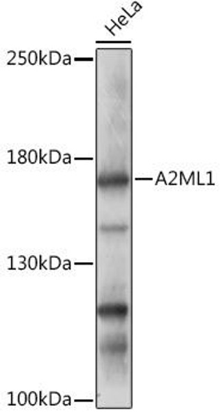 Cell Biology Antibodies 15 Anti-A2ML1 Antibody CAB17831