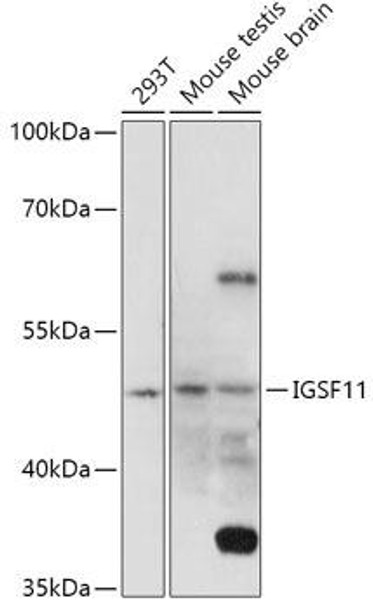 Cell Biology Antibodies 15 Anti-IGSF11 Antibody CAB17837