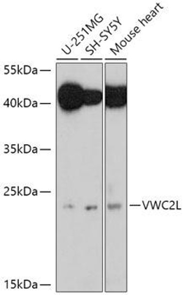 Cell Biology Antibodies 15 Anti-VWC2L Antibody CAB17853