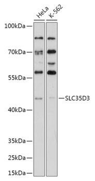 Cell Biology Antibodies 15 Anti-SLC35D3 Antibody CAB17880