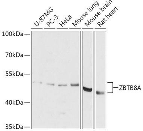 Cell Biology Antibodies 15 Anti-ZBTB8A Antibody CAB17885