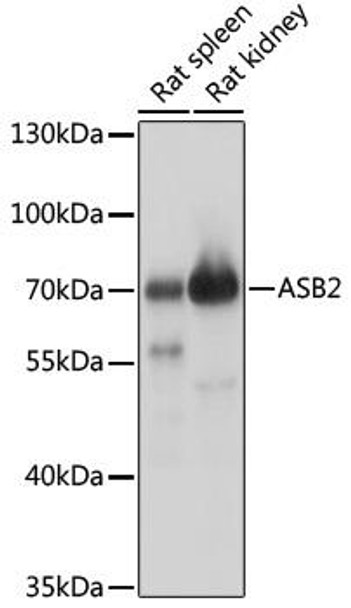 Cell Biology Antibodies 15 Anti-ASB2 Antibody CAB17923