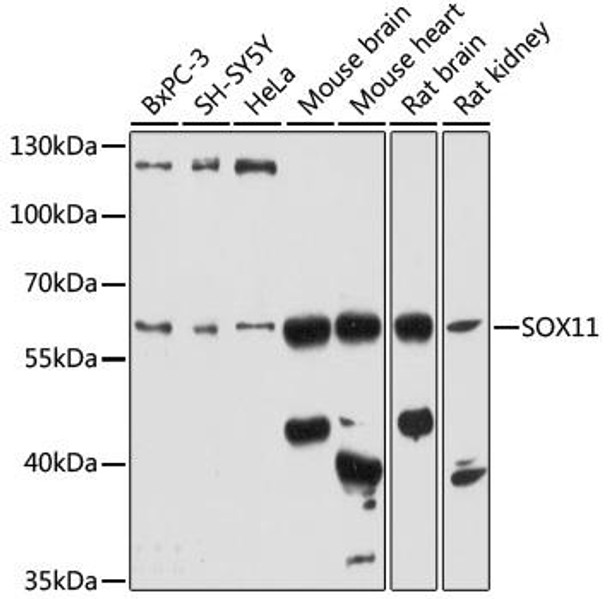 Cell Biology Antibodies 14 Anti-SOX11 Antibody CAB17945