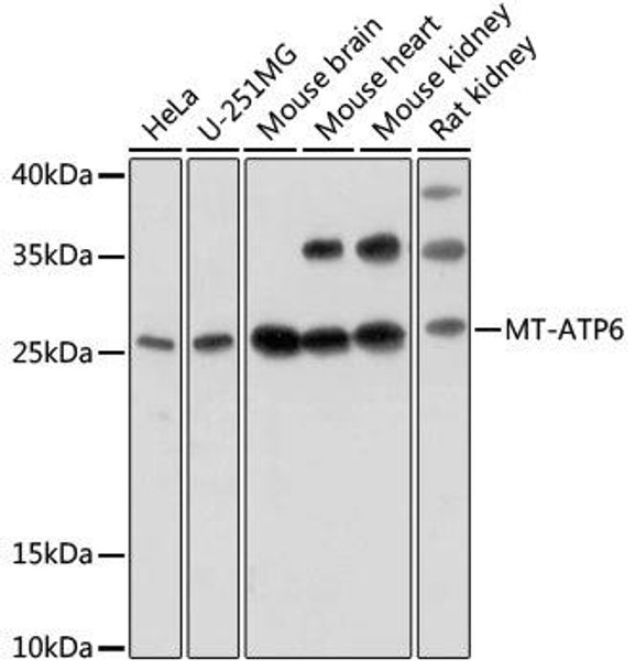 Cell Biology Antibodies 14 Anti-MT-ATP6 Antibody CAB17960