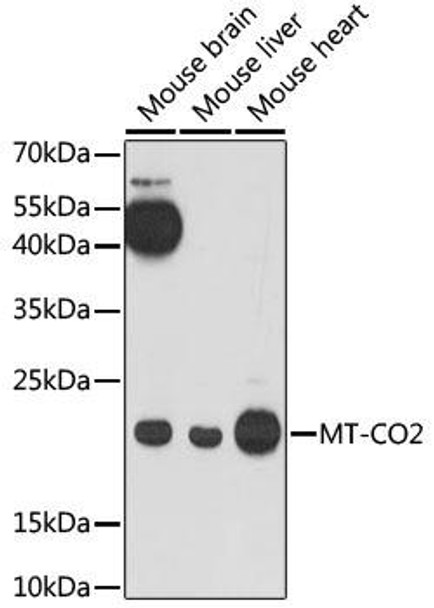 Cell Biology Antibodies 15 Anti-MT-CO2 Antibody CAB17965