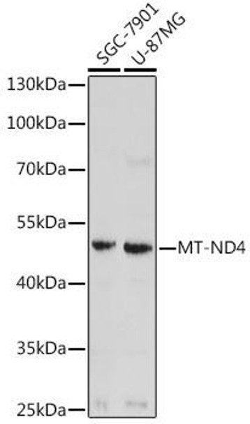 Cell Biology Antibodies 14 Anti-MT-ND4 Antibody CAB17970