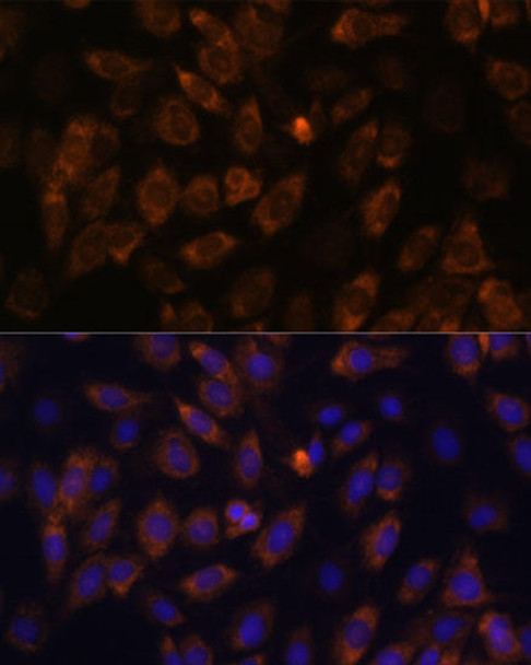 Cell Biology Antibodies 14 Anti-MT-ND4L Antibody CAB17971