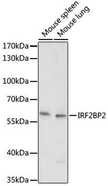 Cell Biology Antibodies 14 Anti-IRF2BP2 Antibody CAB17985
