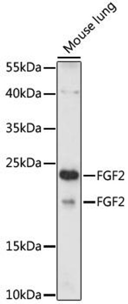 Cell Biology Antibodies 14 Anti-FGF2 Antibody CAB17989