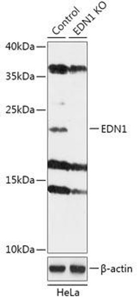 KO Validated Antibodies 1 Anti-EDN1 Antibody CAB18004KO Validated