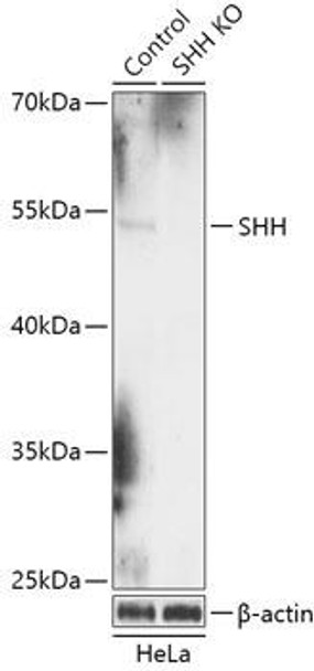 KO Validated Antibodies 1 Anti-SHH Antibody CAB18020KO Validated