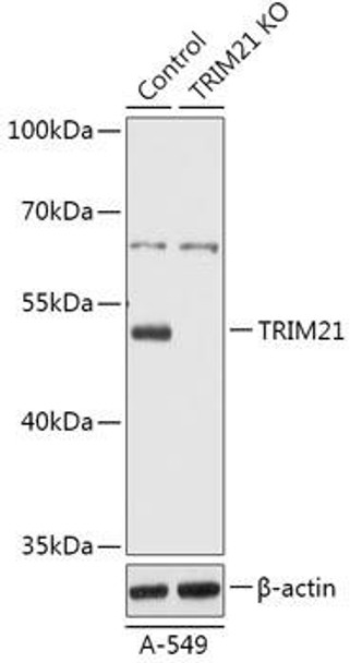 KO Validated Antibodies 1 Anti-TRIM21 Antibody CAB18027KO Validated
