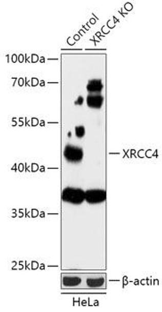 KO Validated Antibodies 1 Anti-XRCC4 Antibody CAB18046KO Validated