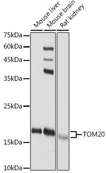 KO Validated Antibodies 1 Anti-TOM20 Antibody CAB18047KO Validated