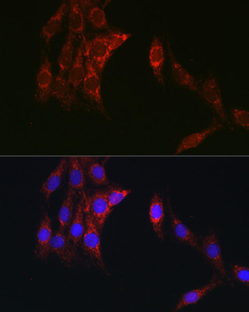 KO Validated Antibodies 1 Anti-TOM20 Antibody CAB18047KO Validated