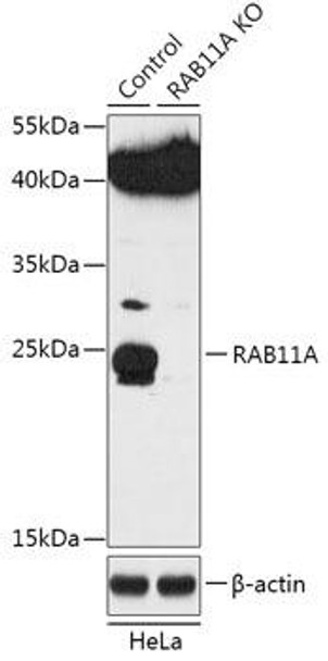 KO Validated Antibodies 1 Anti-RAB11A Antibody CAB18048KO Validated