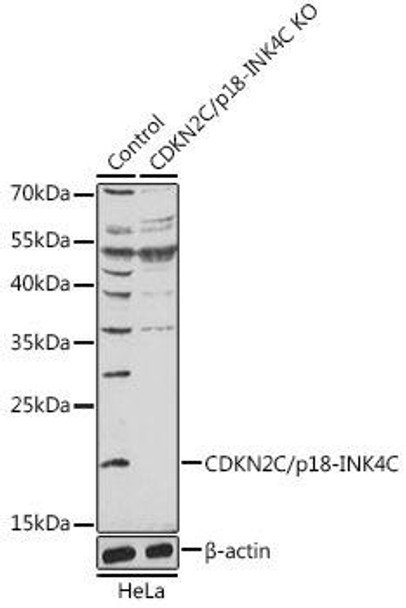 KO Validated Antibodies 1 Anti-CDKN2C/p18-INK4C Antibody CAB18054KO Validated